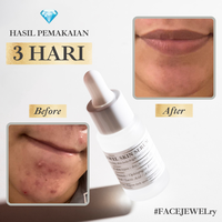 Gambar Jewel Skin Serum -  Wajah dari SA Naturel By Shandy Aulia Kota Administrasi Jakarta Selatan 5 Tokopedia