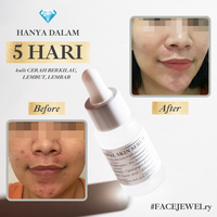 Gambar Jewel Skin Serum -  Wajah dari SA Naturel By Shandy Aulia Kota Administrasi Jakarta Selatan 3 Tokopedia