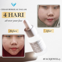 Gambar Jewel Skin Serum -  Wajah dari SA Naturel By Shandy Aulia Kota Administrasi Jakarta Selatan 4 Tokopedia