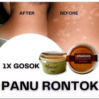 Gambar Sabun Lengkuas Obat Panu Jamur Sabun Adus Gatal Gatal Kulit Panu - Lengkuas Coklat dari VikaStore18 Kab. Klaten 1 Tokopedia