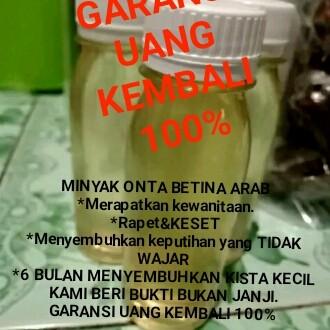 Keputihan Kista serasa gadis garansi 100%