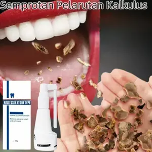 ada 100%ORI Pembersih Karang Gigi Alat Pembersih Karang Gigi Perontok Karang Gigi Paling Ampuh Karang Gigi Perontok 30ml Penghilang Karang Gigi Membandel Obat Perontok Karang Gigi Original