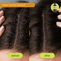 Gambar Dancoly Green Tea Anti Dandruff Shampoo | For Dandruff Hair or Hair With Abnormal Sebum Secretion ) |  Shampoo Anti Ketombe - 80 ml  dari Dancoly Kota Administrasi Jakarta Utara 5 Tokopedia