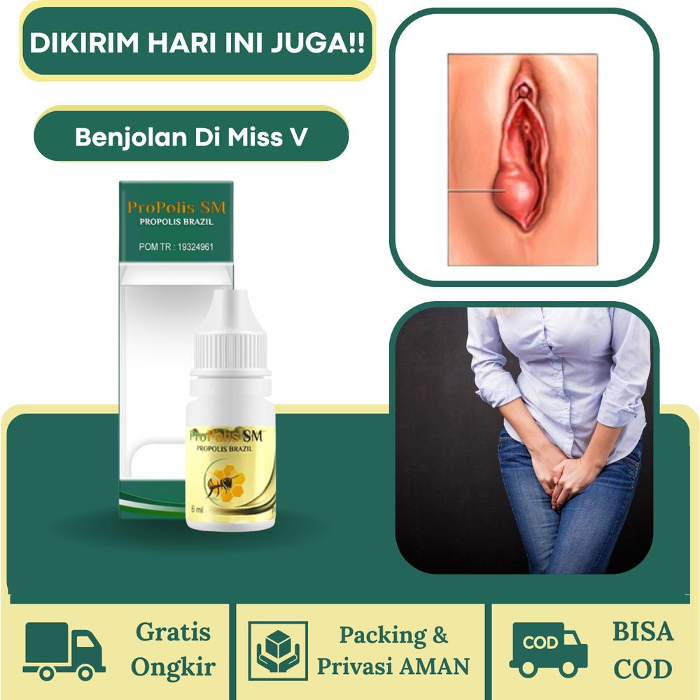 Propolis SM Benjolan Di Miss V Kista Bartholin Penghilang Benjolan Kutil Kelamin Gatal Miss V