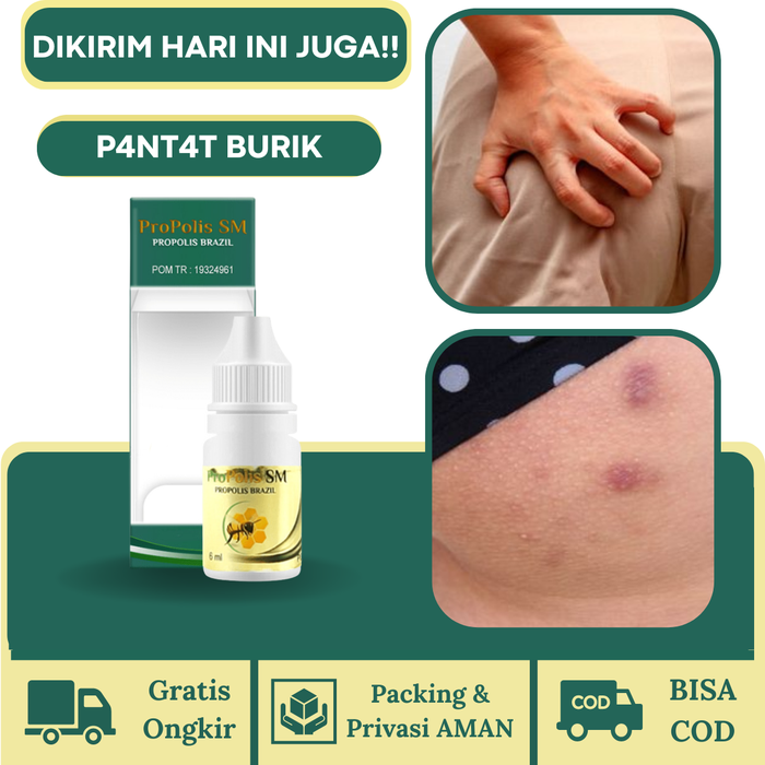 Gambar Penghilang Pantat Hitam Dan Bruntusan, Pembersih Pantat Burik, Bekas Koreng Di Pantat, Propolis Sm Isi 6ml dari Herbalthy Store Kota Administrasi Jakarta Barat Tokopedia