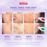 Gambar [NEW] Elsheskin Moisturizer Radiant Glow Series Skincare - MOIS GLOW dari Elsheskin Kota Tangerang Selatan 4 Tokopedia