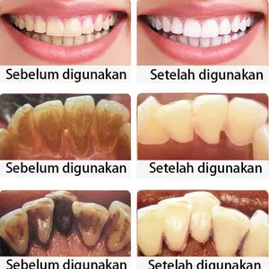 KHUSUS Pasta Gigi Pemutih Probiotik SP7 Pemutih Gigi Kuning Penghilang Karang Gigi Dan Pemutih Gigi Permanen Odol Pembersih Karang Gigi 120g