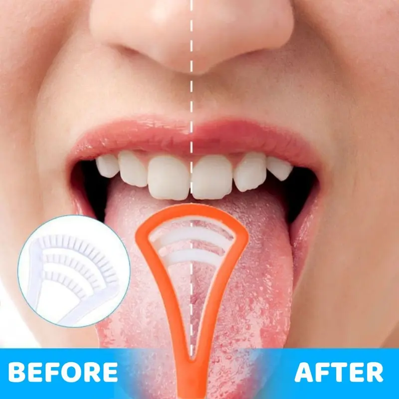 Sikat Pembersih Lidah Tongue Cleaner Scraper / Alat Pengangkat Kotoran Plak Lapisan Putih Kuman Bakteri Jamur Penghilang Bau Mulut Tak Sedap Bahan Plastik + Silicone Mudah Dibersihkan / Perawatan Kebersihan Lidah Mulut Gigi Nafas Segar Gerigi Rubbery 3