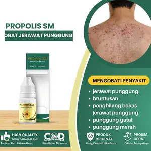 Obat Penghilang Jerawat Punggung, Obat Jerawat Punggung, BruntusanBeruntusan Di Punggung, Obat Jerawat Untuk Di Punggung - Propolis SM