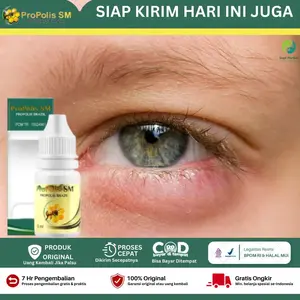 Obat Mata Bengkak Pengempis Bengkak Di Kelopak Mata Penghilang Mata Bintilan Bernanah Kalazion Cendo Luar Dalam Hordeolum Pada Anak Dan Dewasa Benjolan Di Mata Gatal Merah - Propolis SM