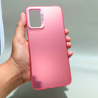 Gambar Case Xiaomi Redmi Note 10 5G - Poco M3 Pro 5G Softcase IMD HOLOGRAM PLATE Case Casing Hp Xiaomi Redmi Note 10 5G - Poco M3 Pro 5G - Hitam, RM NOTE 10 5G dari Drawacc Kota Administrasi Jakarta Barat 4 Tokopedia