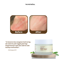 Gambar Bundling 5pcs The Retonical Almond Body Balm Penghilang Bekas Luka | Krim untuk merawat kulit gatal Eksim & Sensitif dari The Retonical Kota Bandung 5 Tokopedia