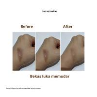 Gambar Bundling 5pcs The Retonical Almond Body Balm Penghilang Bekas Luka | Krim untuk merawat kulit gatal Eksim & Sensitif dari The Retonical Kota Bandung 4 Tokopedia