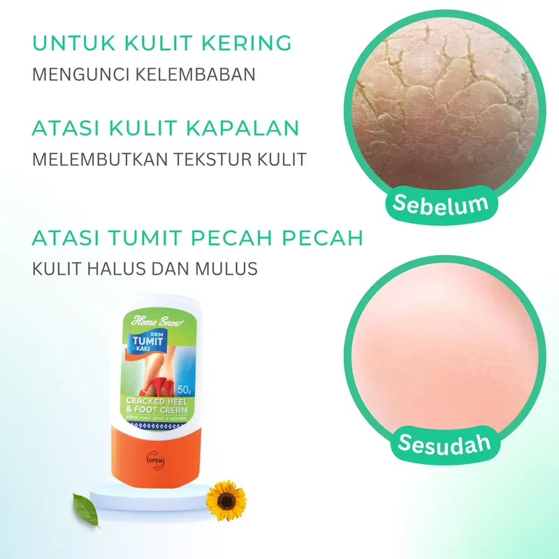 2 Pcs  Home Snow Krim Tumit Kaki 50g-Pelembut & krim tumit pecah-pecah Kapalan Kering 1