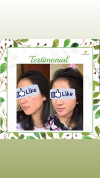 Gambar Golden Viera FREE JARING SABUN /3pcs dari lummyskinid Kota Surabaya 3 Tokopedia