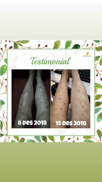 Gambar Golden Viera FREE JARING SABUN /3pcs dari lummyskinid Kota Surabaya 5 Tokopedia