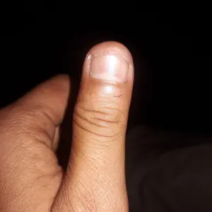 Regulator motor power window xtrail (T30) kanan depan