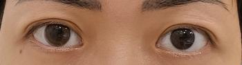 Product Review of Softlens Primo Brown | Kittykawaii [Mikhayloveshop] from Tokopedia customer review 0
