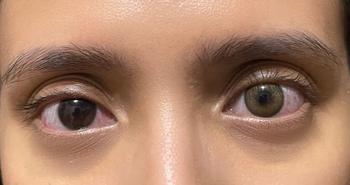 Product Review of Softlens Primo Brown | Kittykawaii [Mikhayloveshop] from Tokopedia customer review 1