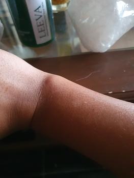 Product Review of Leeva Sabun Exotic Acne 250ml - Sabun Mandi Kulit Sensitif, Mengatasi Jerawat & Panu, Melembabkan Kulit Kering, Solusi Kulit Sehat dan Bersih from Tokopedia customer review 0