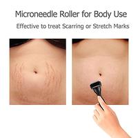 Gambar Derma Roller For Body Hair Beard growth, 2PCK Microneedle Roller Kit dari Beauty USA Jakarta Utara 5 Tokopedia