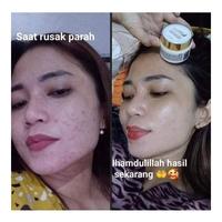 Gambar Ecer Cream MH Miracle Whitening Cream All In One ORIGINAL 100% BPOM dari Sentra Kosmetik ID Kota Bogor 2 Tokopedia