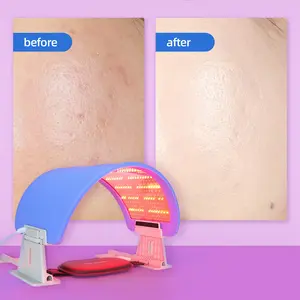 Sabuk Foton Penghilang Keriput Wajah mesin kecantikan salon