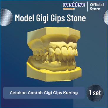 Model Gigi Gips / Model Study Gipsum Praktikum - Gips Kuning - Shop ...