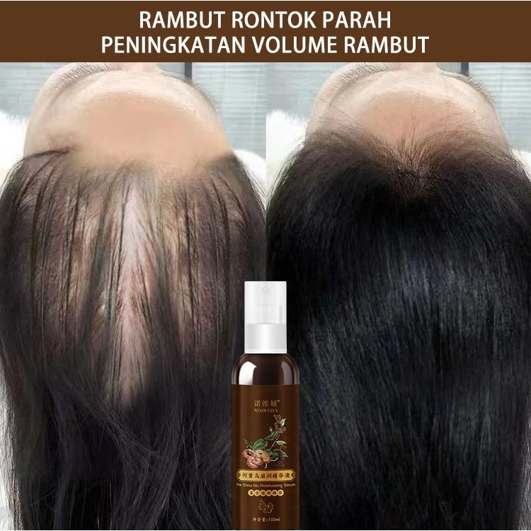 100ml serum penumbuh rambut serum rambut rontok hair tonic rambut rontok minyak penumbuh rambut penumbuh rambut cepat