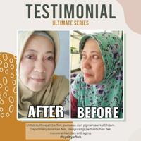 Gambar MS Glow Paket Ultimate - Paket Pencerah, Menyamarkan Flek Hitam Bekas Jerawat, Menghaluskan dan Mengencangkan Kulit dari Citra Loka Indonesia Kota Bandung 4 Tokopedia