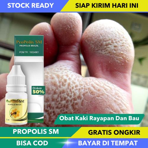 Obat Kaki Rayapan Dan Bau, Obat Pitted Keratolysis, Obat Kamitetep, Ob