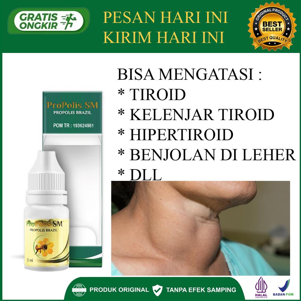 Obat Tiroid Di Leher Paling Ampuh, Penghancur Kelenjar Getah Bening,go