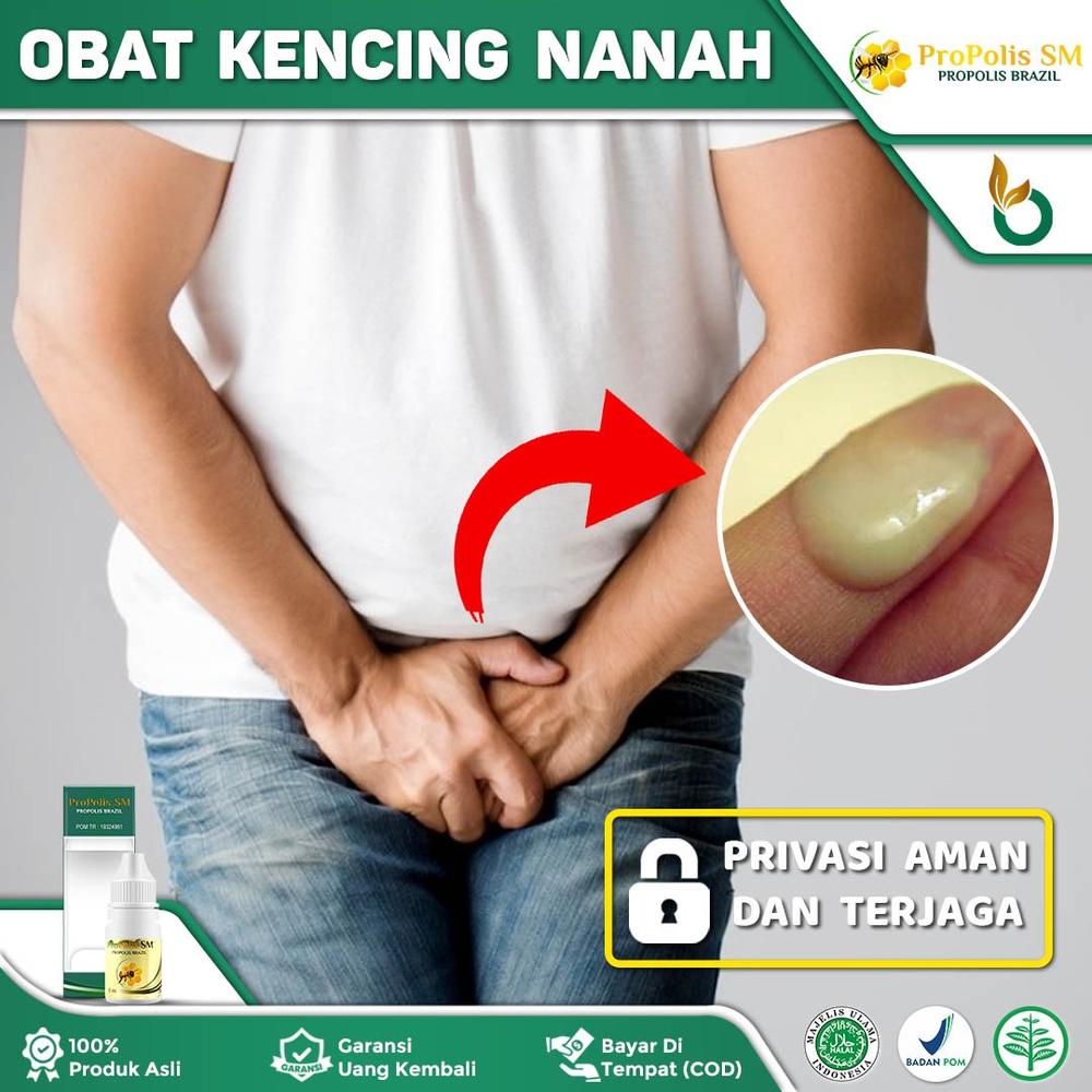 Obat Kencing Nanah, Gonore, Sipilis, Raja Singa, Kencing Sakit Perih,