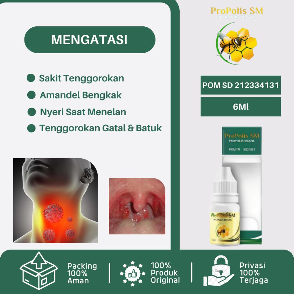OBAT SAKIT TENGGOROKAN, OBAT RADANG TENGGOROKAN, OBAT NYERI TENGGOROKAN SUSAH MENELAN, OBAT TENGGOROKAN GATAL DAN BATUK, OBAT TENGGOROKAN KERING, OBAT TENGGOROKAN MENGGANJAL, OBAT AMANDEL SAKIT TENGGO