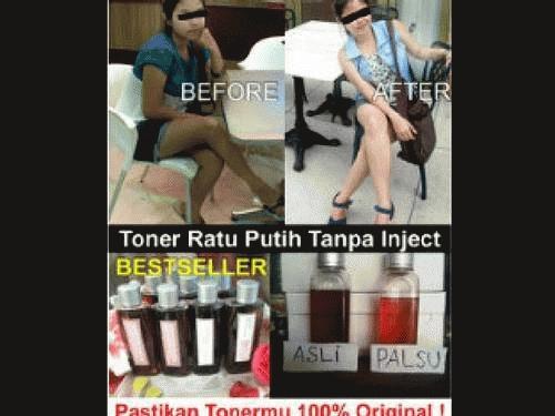 Gambar Toner Apotik Ratu ! PEMUTIH BADAN,PENGHILANG LUKA BESTSELLER ! dari Piggieolshop Kota Administrasi Jakarta Barat Tokopedia