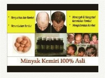 Gambar MINYAK KEMIRI dari KIREI NA OLSHOP Kab. Sleman Tokopedia