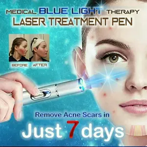 Facial blue laser pen laser biru penghilang jerawat antiaging bekas