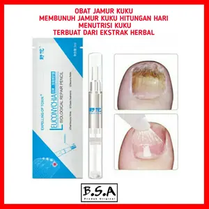 OBAT JAMUR KUKU MEMBUNUH JAMUR KUKU HITUNGAN HARI
