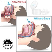 Gambar Anti Ngorok Pernafasan Hidung Stop Snoring Solution - MX-555 - Blue dari web komputindo Kota Administrasi Jakarta Pusat 3 Tokopedia