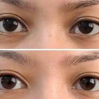 Gambar The Ordinary Caffeine Solution Eye Serum dari Ladieshouse Jakarta Barat 3 Tokopedia