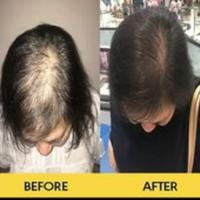 Gambar Serum rambut rusak/treatment rambut/keratin serum/GARANSI UANG KEMBALI dari CHORIO INDONESIA Kota Administrasi Jakarta Barat 3 Tokopedia