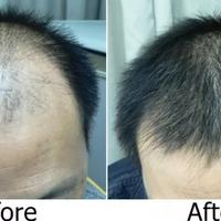 Gambar Serum rambut rusak/treatment rambut/keratin serum/GARANSI UANG KEMBALI dari CHORIO INDONESIA Kota Administrasi Jakarta Barat 4 Tokopedia