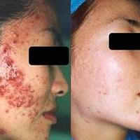 Gambar Mimba Salep dari Sartika Herbal Kota Tangerang 3 Tokopedia