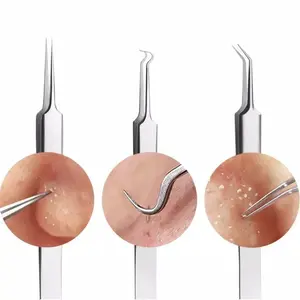 3 Pcs Pinset Jepit Komedo Blackhead remover tools Pinset Jerawat