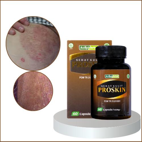 Proskin Untuk Gatal Hitam Di Selangakangan Kering Lecet Kurap Kudis Eksim - Sehat Kulit Proskin