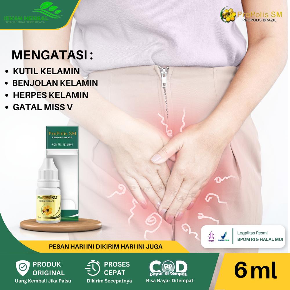 ProPolis SM Untuk Obat Penghilang Kutil di Kemaluan Wanita, Kutil di Kelamin Wanita, Gatal Miss V, Kutil Pada Miss V, Miss V Kutilan, Herpes Genital, Penghilang Benjolan di Kelamin