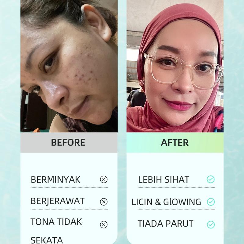 Kulit Jadi Glowing dalam 7 Hari !!! Dapatkan "Bellesa Beauty Skin Set…